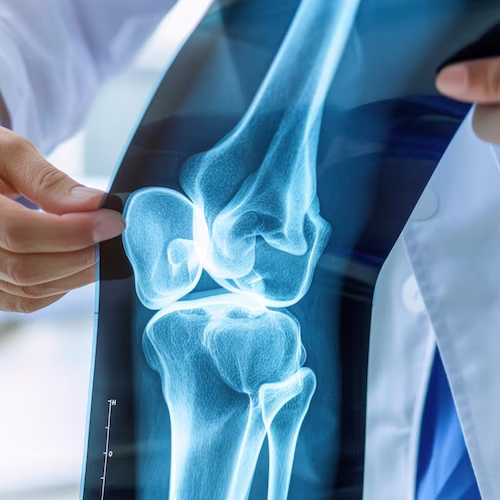 orthopedic specialist in guntur